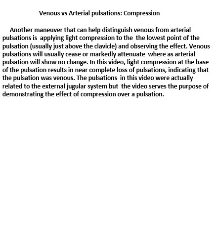 Image showing neck vein landmarks