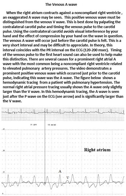 Image showing neck vein landmarks